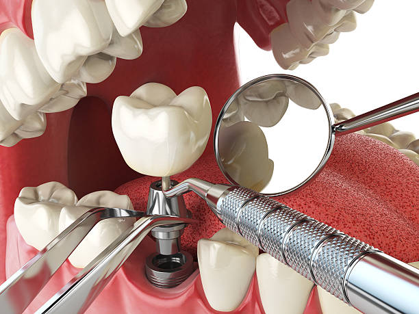 Best Emergency Treatment for Jaw Pain or Injury in Cambridge, MN
